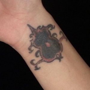 Wrist Tattoo Before Treatment